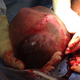 Illustration for article titled Rare Images Of A Baby Born While Still Inside The Amniotic Sac